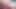 アナルブーマイーリミックス