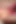 Anal Fail Readons #1: Why When I Fart Man’s Cocks Are Falling?