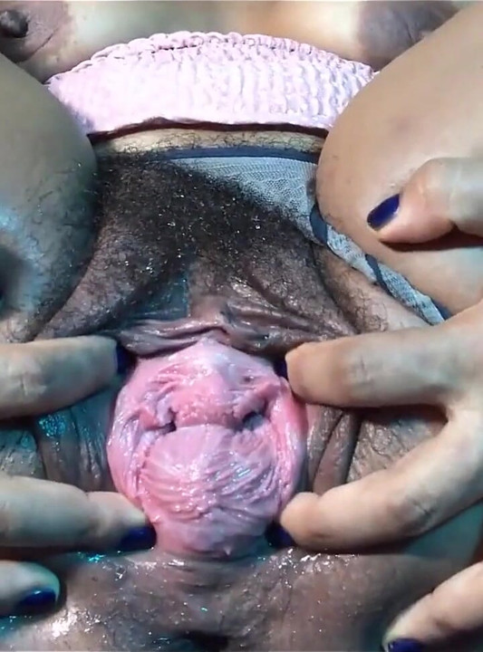 Âm hộ ngon ngọt và đau nhói