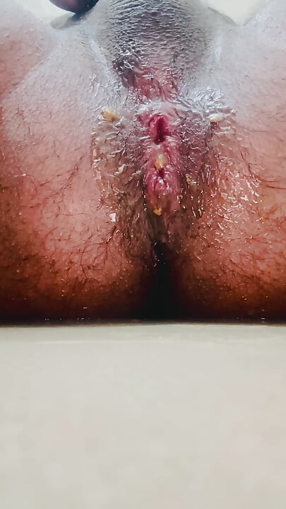 Putting Radish