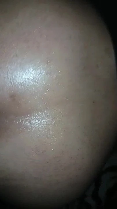 Coroa rabuda