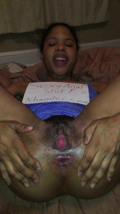 I want everyone to see my asshole! Part 2!