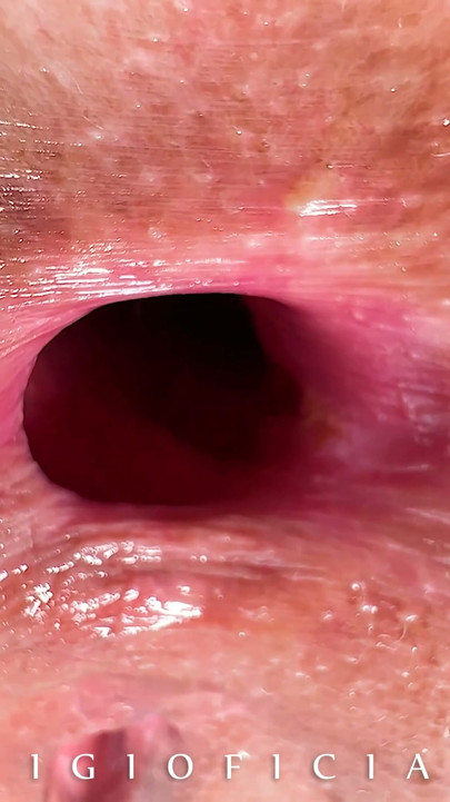 Greatest video with anal breathing close up with the most beautiful girl you ever seen! | Clip 1