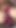 リアル78歳熟女初の異人種間アナル