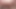 Shower enema explosion 2 Apr-16-2015
