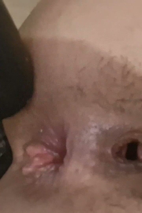Dilation