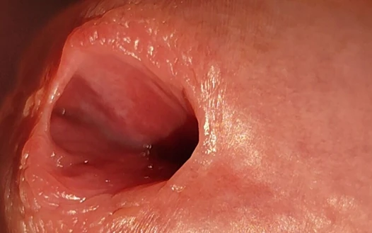 Bir Penis Başı Deliği Nasıl aşırı Derecede Genişletilir.