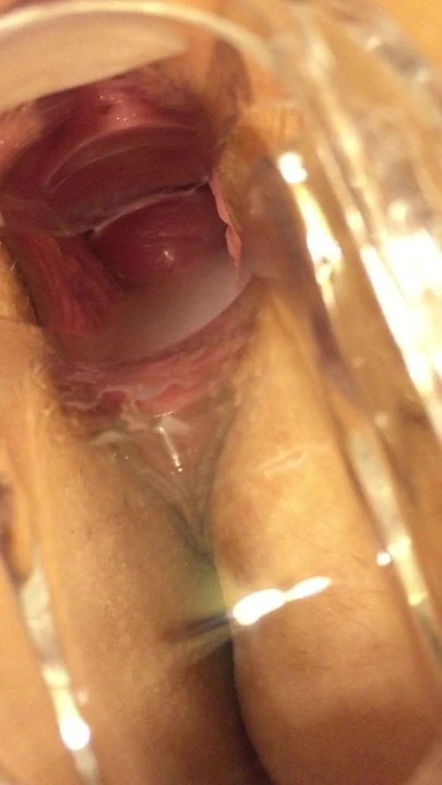Wife speculum in pussy cervix 5