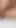 Jaw-dropping moment from "A 20yo student almost got her first anal prolapse"
