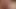 Complication of Constance constantly masturbating
