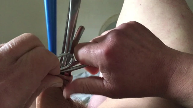 Saturday foreskin - scissors plus four spoons