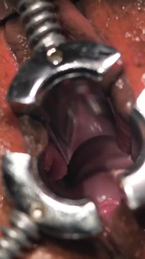 Fisting, medioeval Speculum and Orgasm for Lady Sonia milf.mp4 | Clip 1
