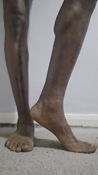 My feet need attention