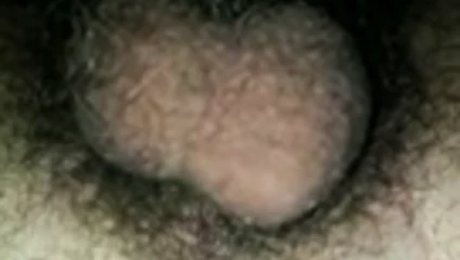 Haariger Sack