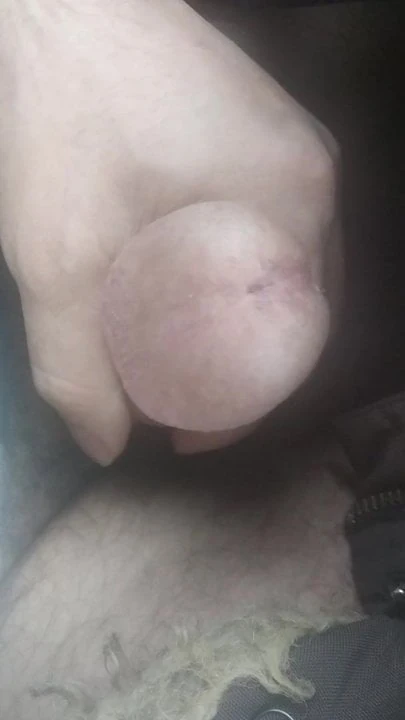 Alvas