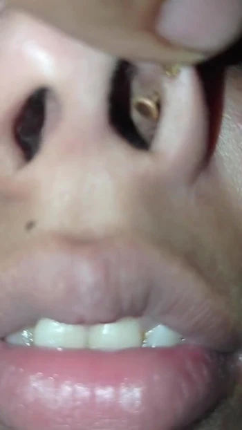 Spectacular moment from "Nose pulling Twisting pinching, Requested video Funny video"