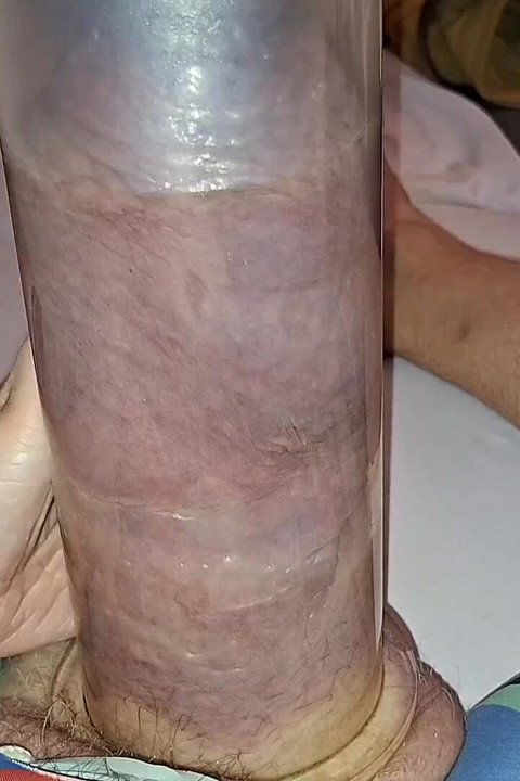 Bombeando o Monstro!!