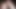 Long Foreskin Movement (slowmotion) 478