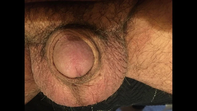 My micropenis slideshow