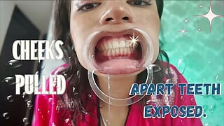 Many Vids