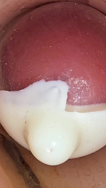 Derin amcıktaki kamera prezervatife büyük bir sperm boşalmasını kaydediyor
