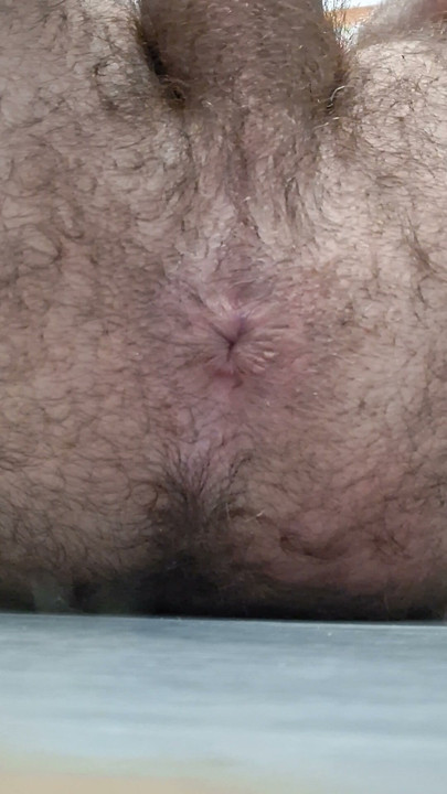 Asshole in close-up