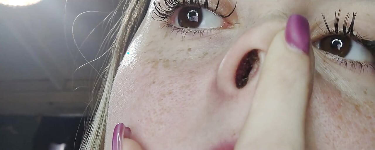 Runny Nose Close up