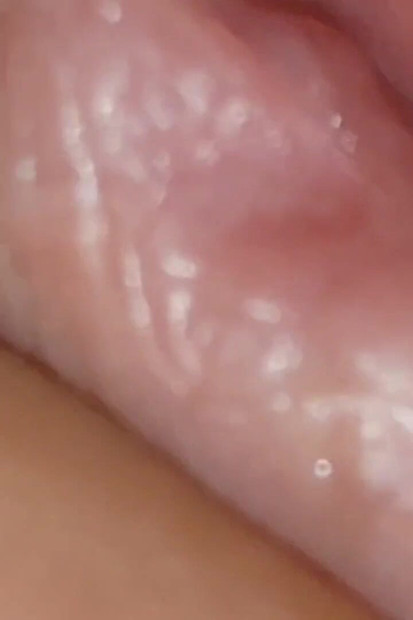 Nevjerojatni glavić