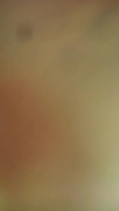 Anal