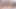 A beauty Prolapse-Play & Prolapse-Dildo & Prolapse-Pump - Rosebud & Prolapse deep anal Fuck in my horny ass