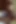 Appalachian dani siyah yarak oral tedavi gözden geçirildi