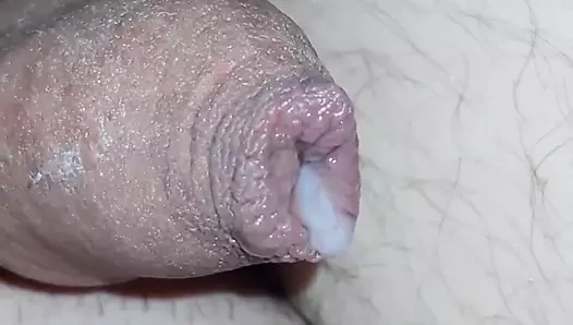 Sünnetsiz küçük yarak boşalması