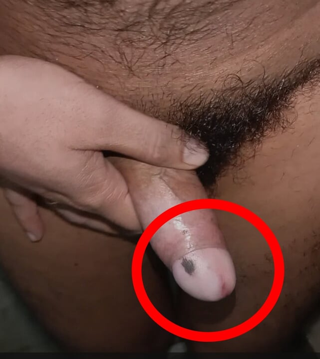 Teen pusssy my big dick small ussy savad pussy imole dick big dick compilation hard-core solo other  videos &amp;