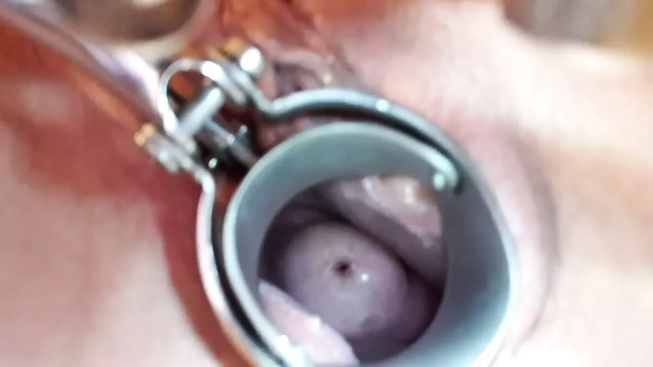 Julie's speculum