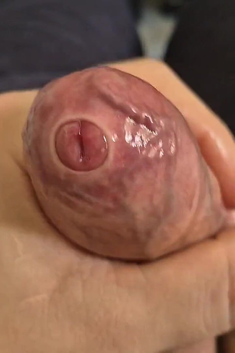 Tight Uncut Phimosis Cock Stretched Close up! Raw Foreskin Play