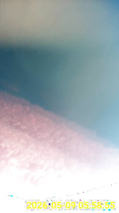 Close up of buttplug & HD Endoscope insertion