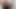 Hotkinkyjo منظار XO الشرجي المتطرف! مشروع HKJVR