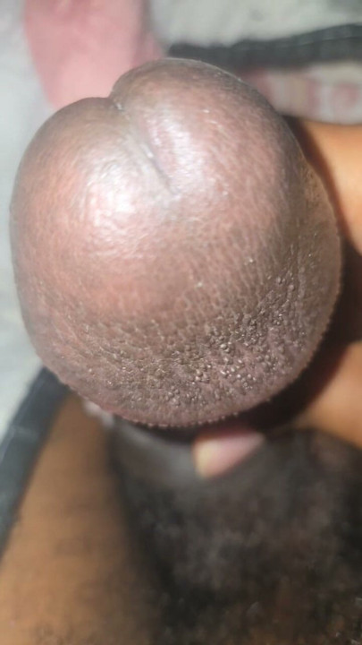 Huge mushroom