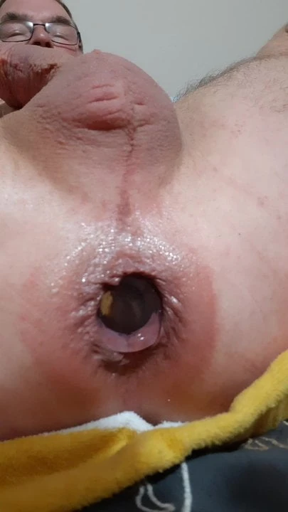 Anal play