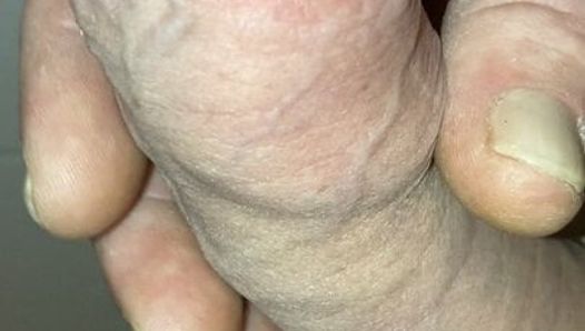 Foreskin close up cockhead edging and cumshot