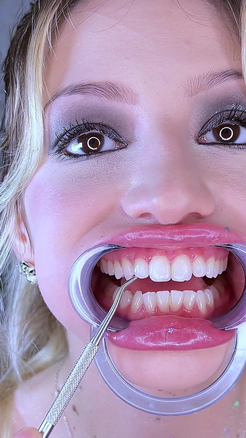 Teeth Fetish Extreme Close-up Dental Examination