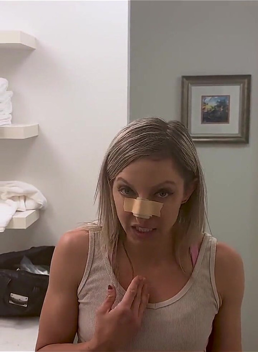 Boxer Lora Cross Breaks Nose and Gets a Nose Cast
