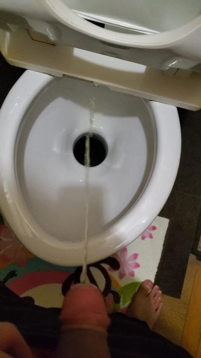 First post is urine