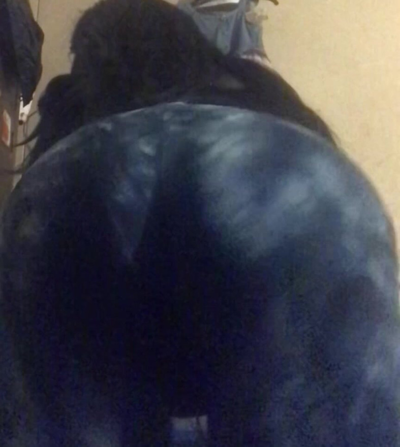 Cheeks Clapping