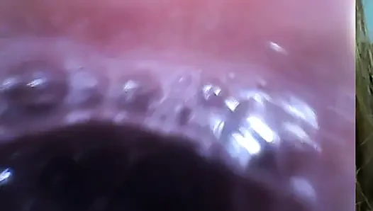 Endoscopy!! Giantess Swallowed a 25 Members at Same Time