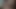 私と甘い夢！