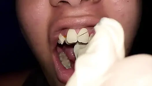 Trying to Use Dental Floss (close-up)