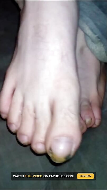 Foot Fancies