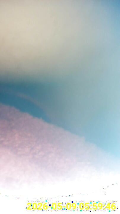 Close up of buttplug & HD Endoscope insertion