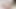 Penis-Untersuchung mit deutscher Krankenschwester, schwarzer Dame, auf 4k hochskaliert